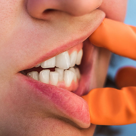 How Do Crooked Teeth Affect Clear Speech?